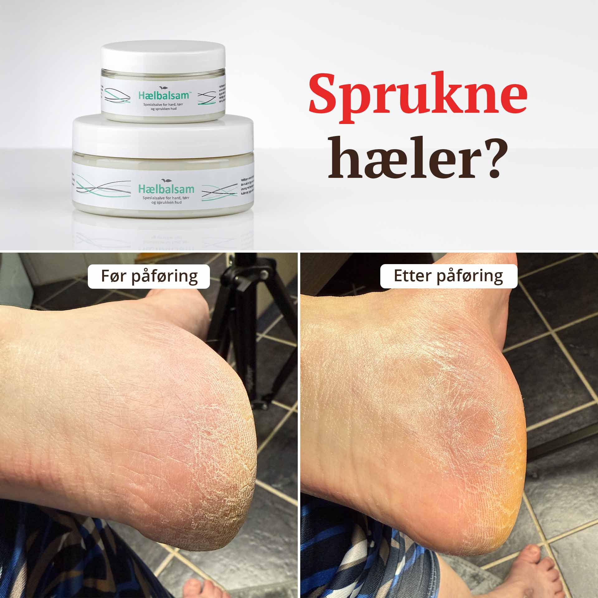 Hælbalsam 250 + 100 ml - ved hard, tørr og sprukken hud