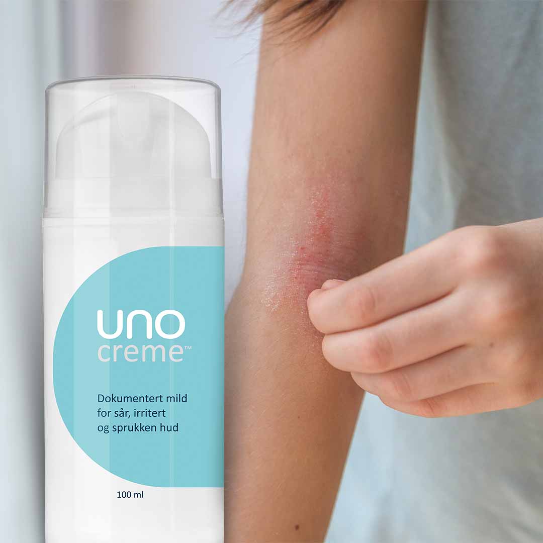 DEAL - 2 stk UnoCreme - for sår, rød og irritert hud