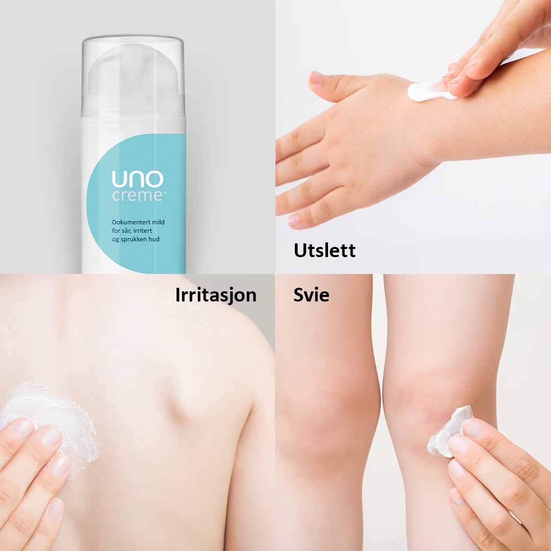 DEAL - UnoCreme - for sår, rød og irritert hud