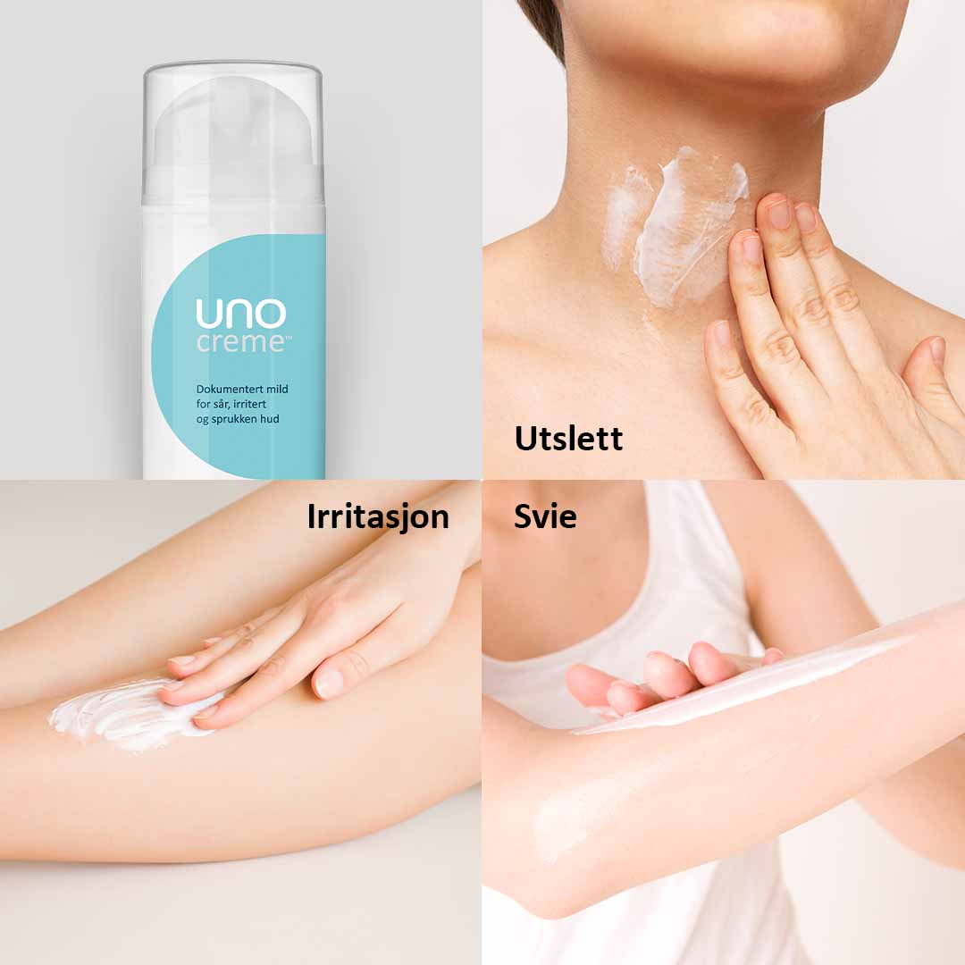 DEAL - UnoCreme - for sår, rød og irritert hud