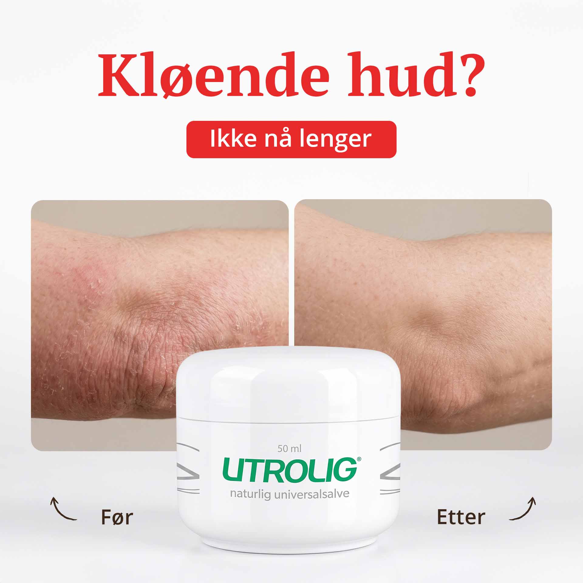 DEAL - Utrolig Sommer kos