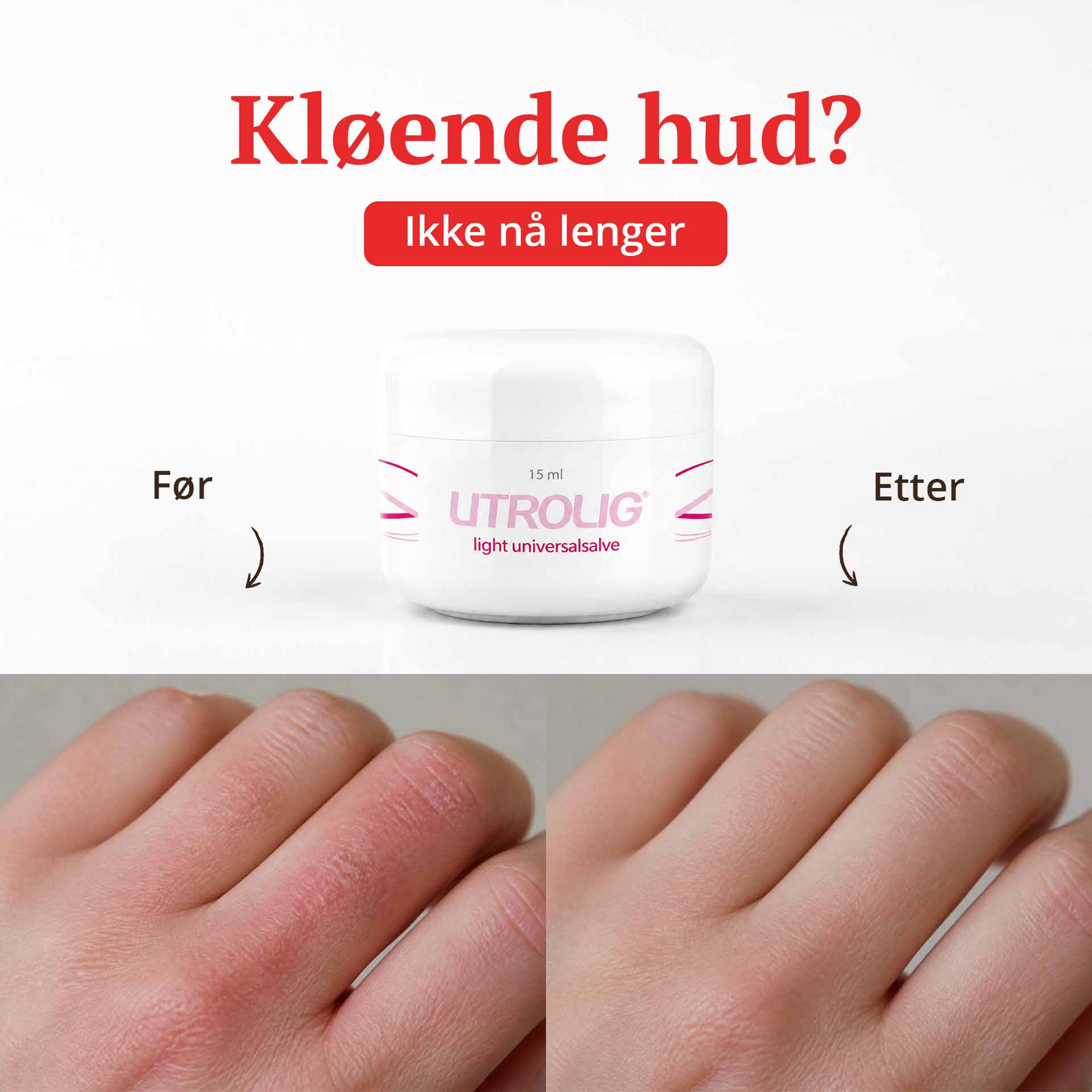 DEAL - Utrolig Light Universalsalve 15 ml
