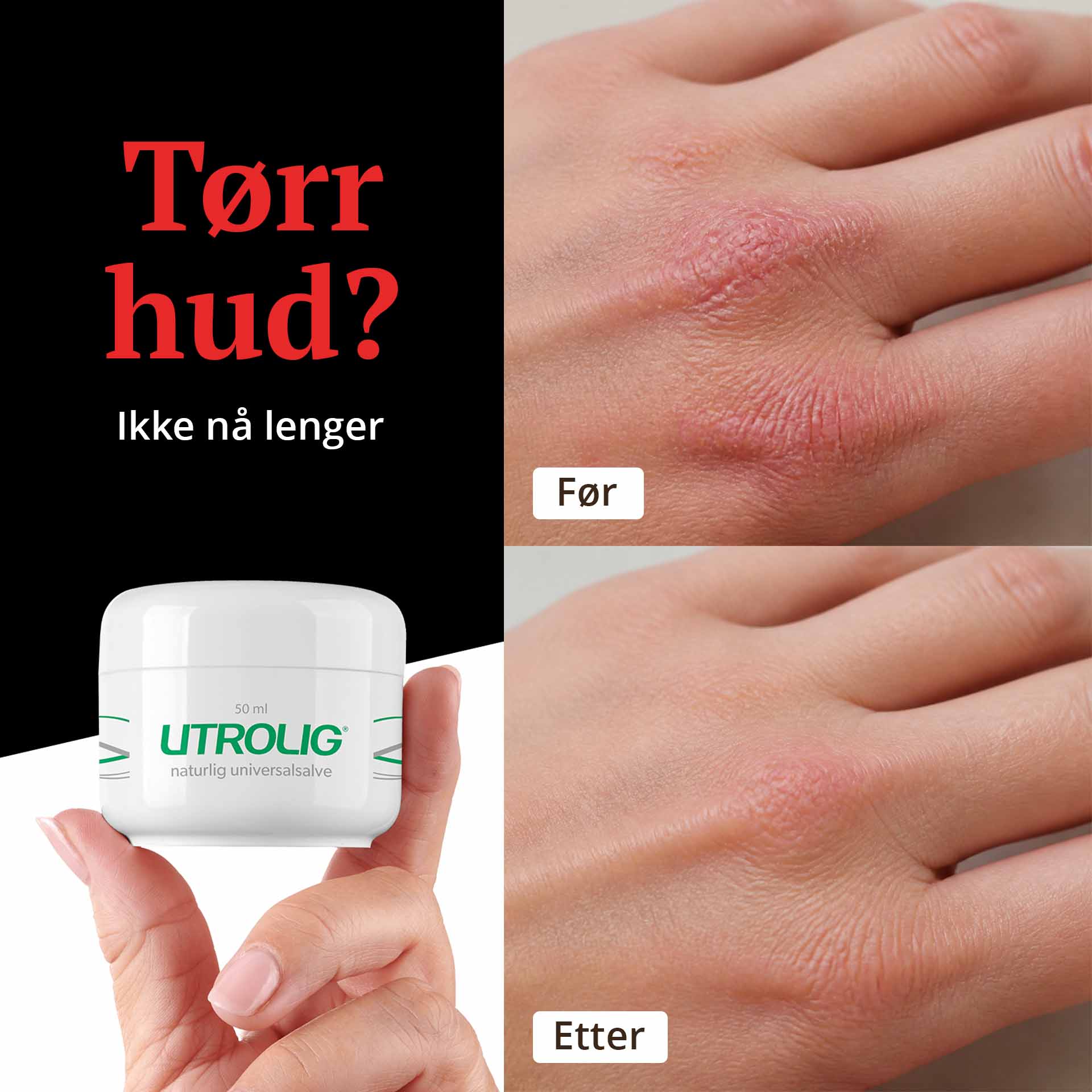 DEAL  - 2 stk Utrolig Naturlig Universalsalve 50 ml