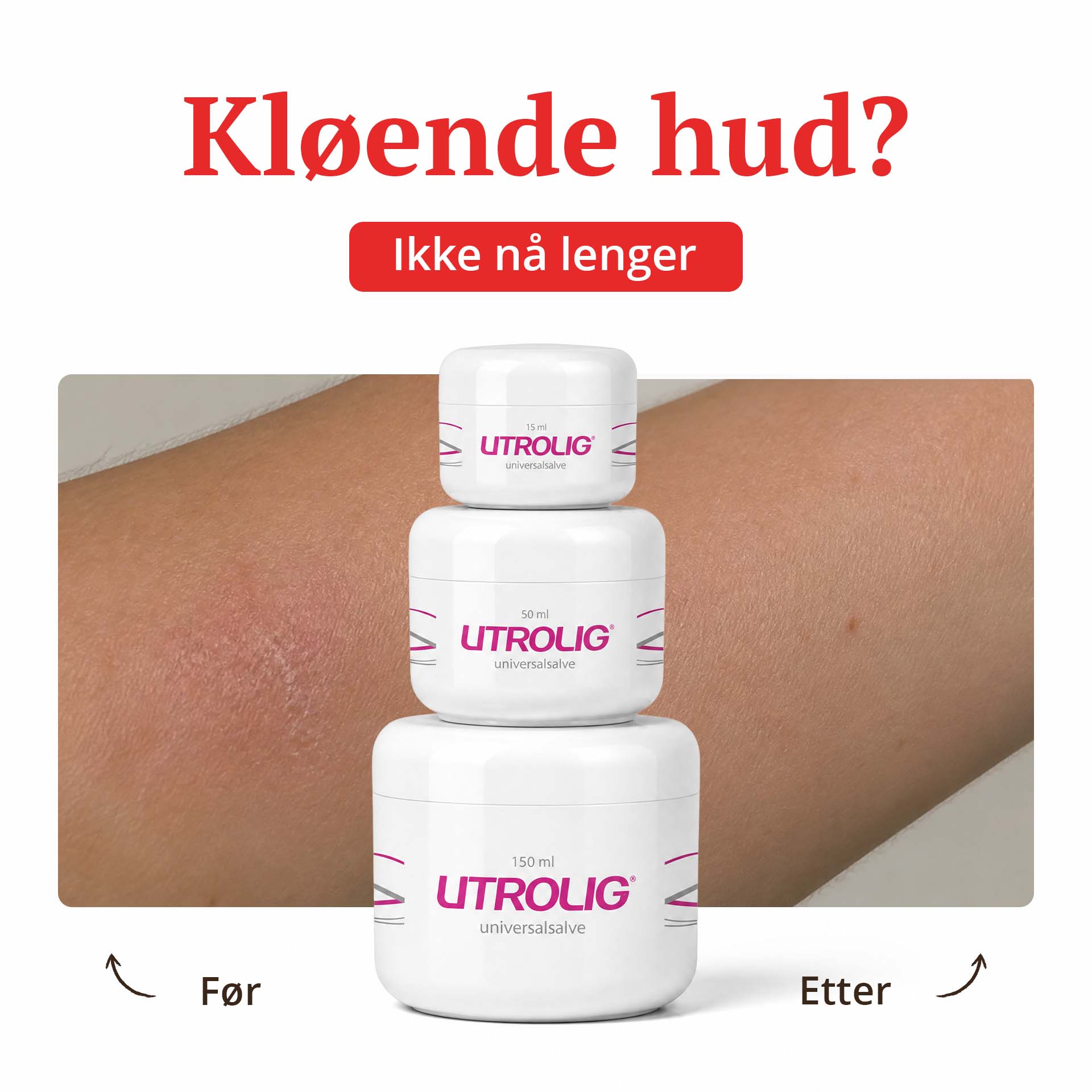 Utrolig Universalsalve 150 ml - den største krukken