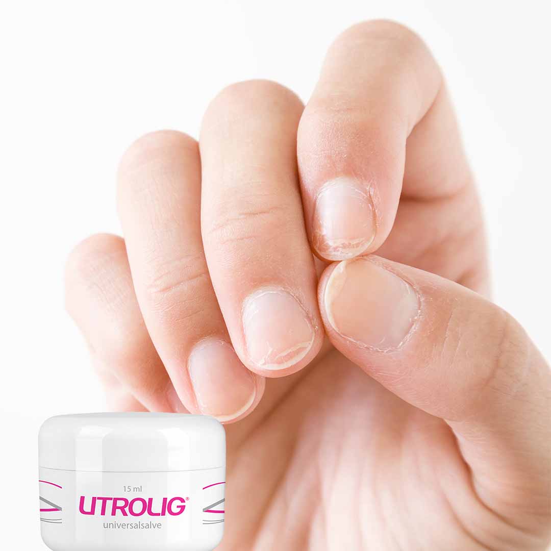 DEAL - Utrolig Liten og Stor - Den største og den minste krukken